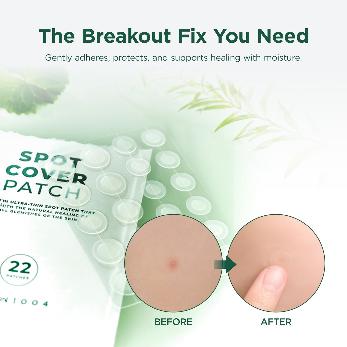 SKIN1004 Madagascar Centella Tea-Trica Spot Cover Patch 22pcs